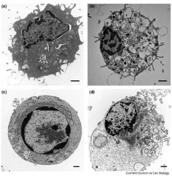 Figura 5: Micrografias eletrônicas ilustrativas dos tipos de morte celular e  as suas características morfológicas