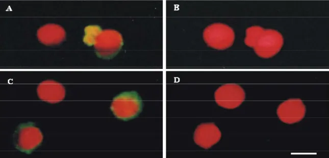 Figura 07. Células HSG (A e B) e OSCC-3 (C e D), após o ensaio de TUNEL,  observadas ao microscópio de fluorescência