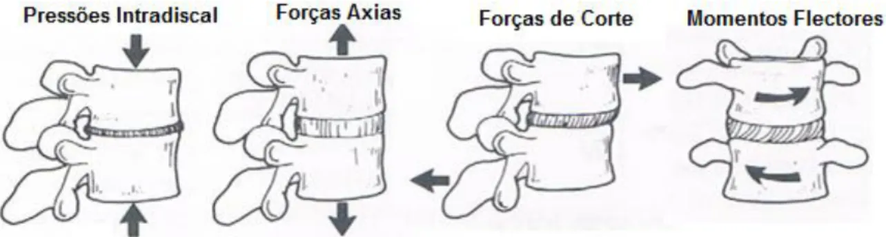 Figura 1: Demonstração da orientação das forças resultantes do movimento com carga na coluna vertebral (adaptada de: 