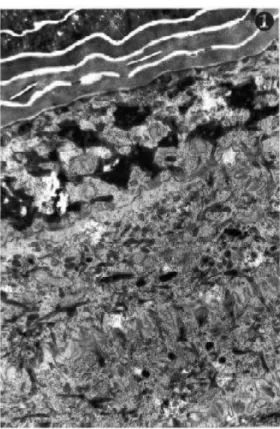 FIGURA  2  –  ELETROMICROGRAFIA  DE  BAIXA  AMPLIAÇÃO  DE  EPIDERME  HUMANA,  DEMONSTRANDO  O  ESTRATO  SUPERIOR  ESPINHOSO,  ESTRATO  GRANULOSO, E PARTE DO ESTRATO CÓRNEO