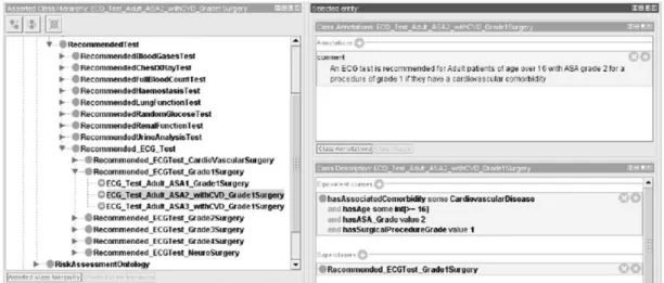 Figura 2.9 - Exemplo da utilização da ontologia na definição de uma regra para a recomendação  de exame de ECG (Eletrocardiograma)