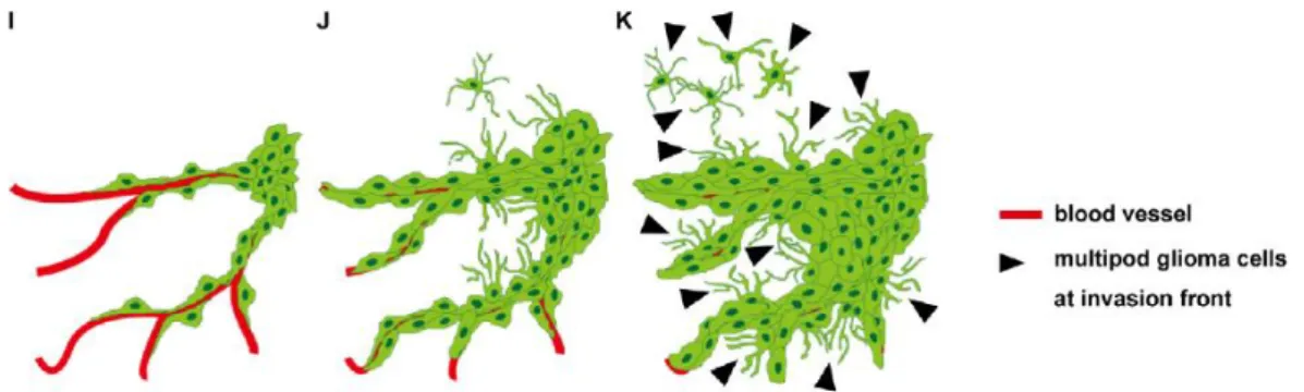 Figure 1.5: Hypothetic model of GBM progression. Two distinct cellular morphologies whether  cells invade along the periphery of blood vessels (I) or through the brain parenchyma (K)