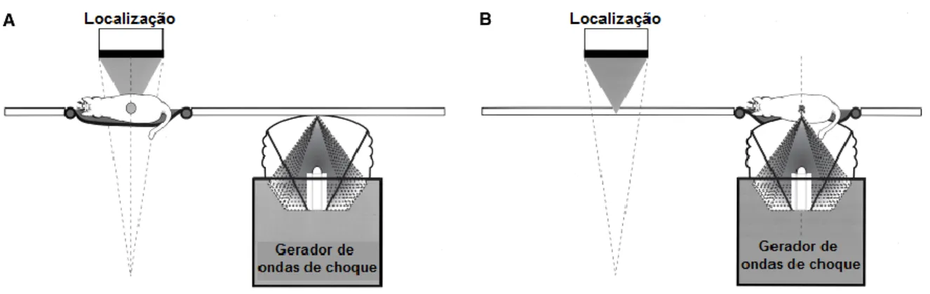 Figura 12 - Ilustração esquemática da litotrícia extracorporal por ondas de choque 