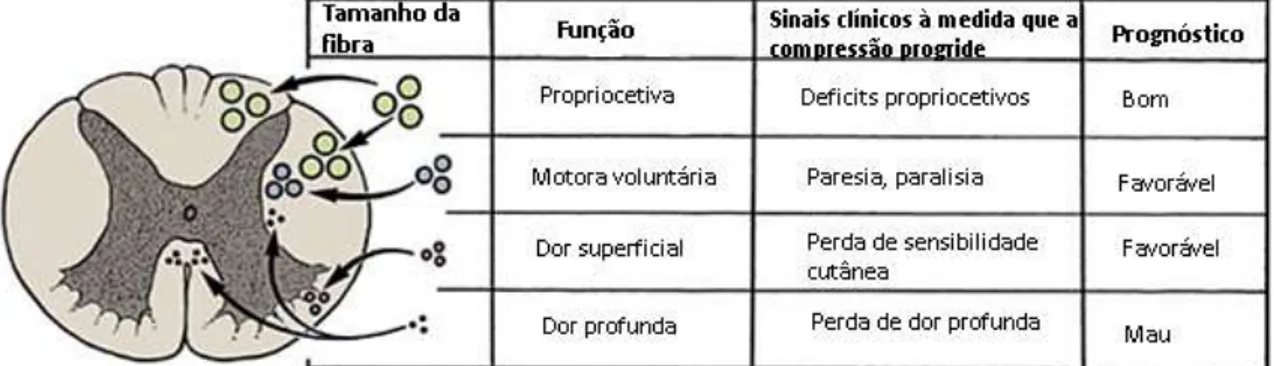 Figura 14: Progressão dos sinais clínicos na compressão da medula espinhal (adaptado de  Lorenz, Coates &amp; Kent, 2011)