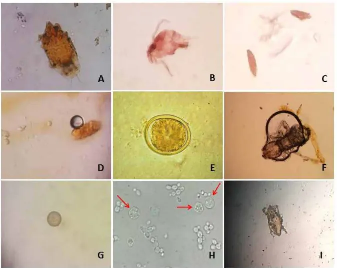 Figure 2 – Structures found in meat samples (sausage, ham, minced meat and chicken)   fractionated and sold in bulk in supermarkets in Teresina, PI