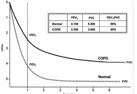 Figura 1.4 - Traçado espirométrico e cálculo do FEV1, de FVC e da relação FEV1/FVC. 
