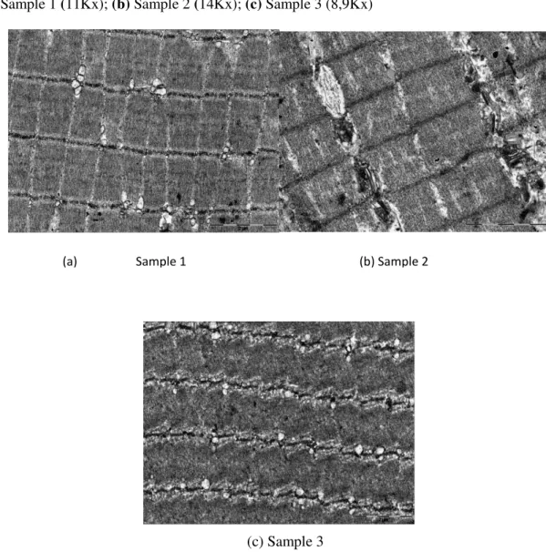 Figure 1. Micrographs of sun-dried beef. Longitudinal sections of myofibrils. Magnification:  