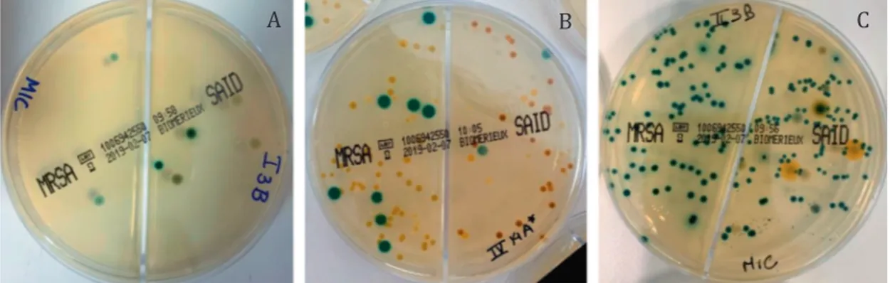 Fig. 2. Example plates with MRSA and MSSA colonies. (A) &lt;5 colonies; (B) 5 to 15 colonies; (C) &gt;15 colonies.