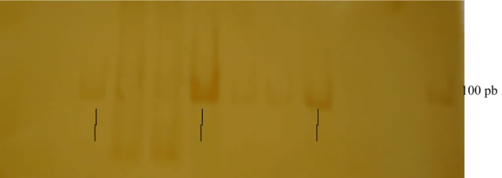 Figura 4. Amplificação do gene GPX3 da amostra 57 de tecido normal (não metilada) e das  amostras 30 e 1 (não metilada) de câncer gástrico em gel de poliacrilamida a 8%, corado com  prata