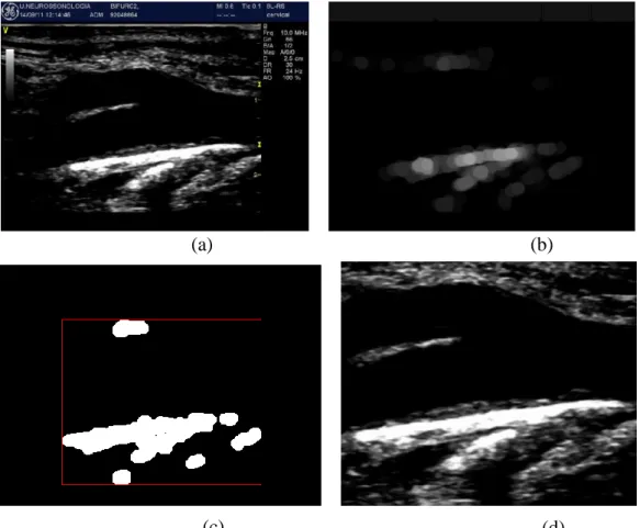 Figure  2:  Automatic  identification  and  consequent  isolation  of  image  area:  (a)  Original  image;  (b)  After  the  morphological opening; (c) After Thresholding, and definition of a rectangular area, based on  the first and last  nonzero lines an