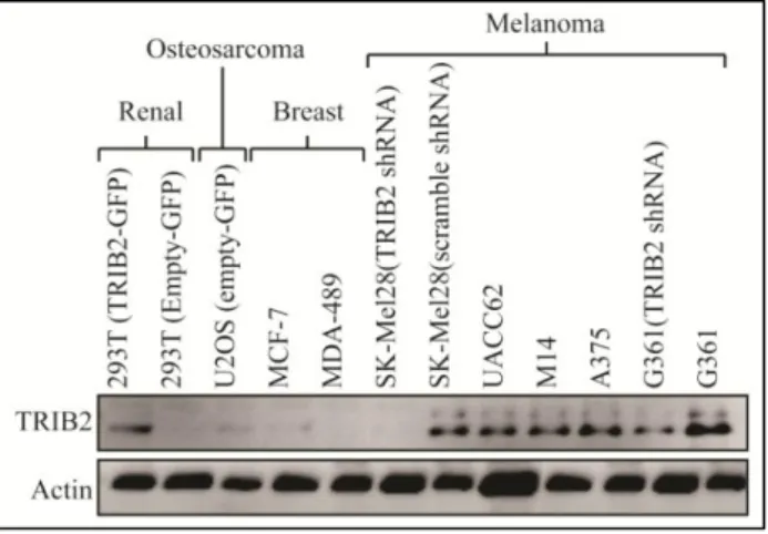Figure  4.1.1:  A  representative  western  blot  showing  the  expression level of TRIB2 and actin in our isogenic cell lines