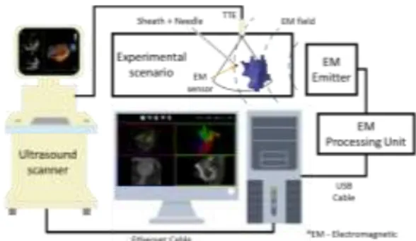 Figure 2 – Overview of the developed interventional setup.  