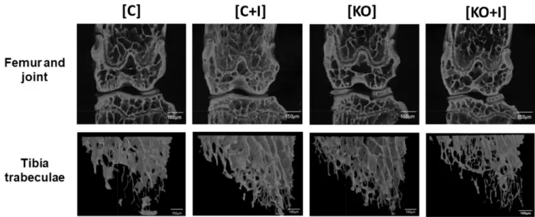 Fig 4. Micro-CT scans showing bone status from femur and tibia. Evaluation of microarchitecture parameters following three-dimensional reconstructions from micro-CT scans of femur and tibia as described previously