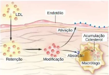Figura 2.2 – Ativação endotelial por infiltração de LDL.  Particularmente em doentes com  hipercolesterolemia,  o  excesso  de  LDL  é  retido  na  camada  íntima  arterial