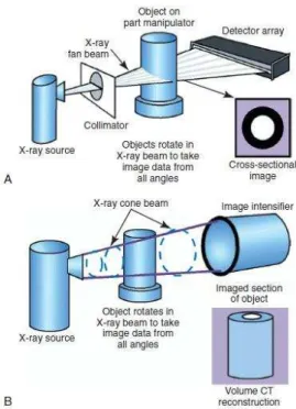Figura  9  -  Tomografia  Computorizada  vs  Tomografia  Computoriza da  de  Feixe  Cónico