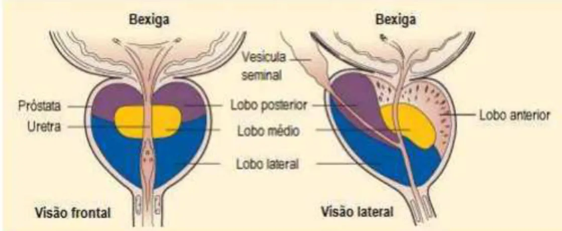 Figura 10. Visão lateral e frontal da próstata mostrando divisão em lóbulos. Adaptada de José Dias, 2014