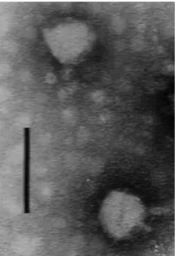 Fig. 1. Phage phiIBB-PAA2 observed by TEM. (Bar corresponds to 100 nm).