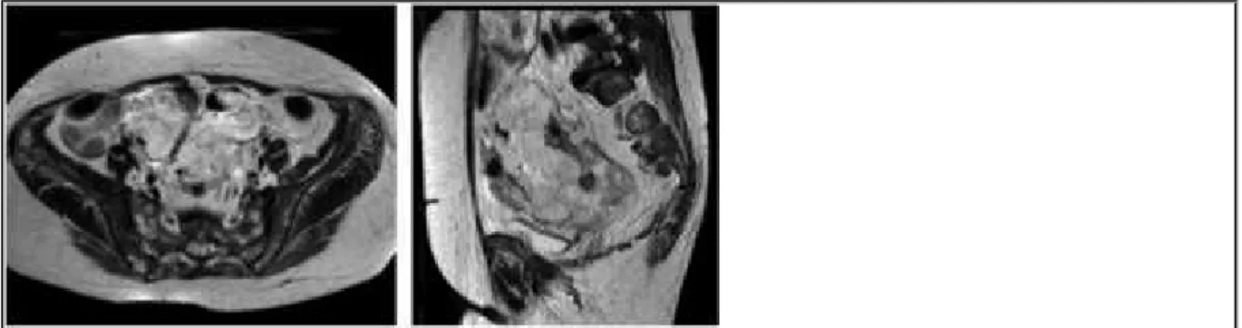 Figure 7 a) Axial T2-weighted image. b) Sagittal T2-weighted image.