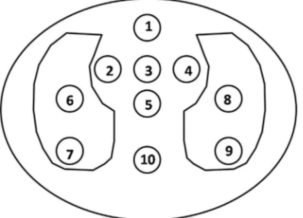 Figure 1. Representation of the central slice of the CIRS phantom with location and corresponding labels for the dose measuring points