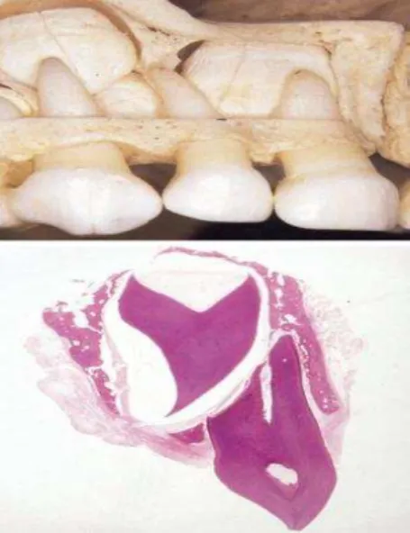 Figura 19: Relação anatómica e histológica entre o dente decíduo e o seu sucessor permanente  (Christophersen, Freund &amp; Harild, 2005)