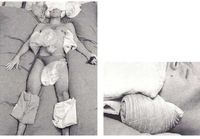 Fig. 4 – Estruturação do Self. Rio de Janeiro, 1976.