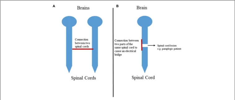 FIGURE 3 | (A) Schematic of the connection between two spinal cords. (B) Representation of the connection between two parts of the same spinal cord in a paraplegic patient.