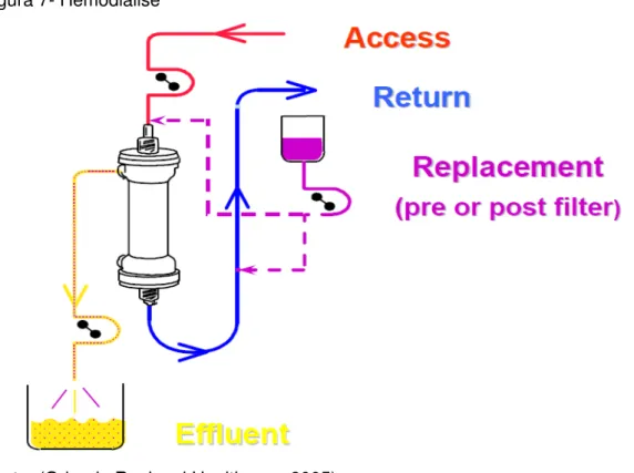 Figura 7- Hemodiálise 