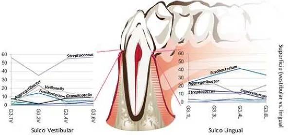 Figura 1 – Variação na composição de bactérias no sulco gengival no 3º quadrante a vestibular  (esquerda) e a lingual (direita)