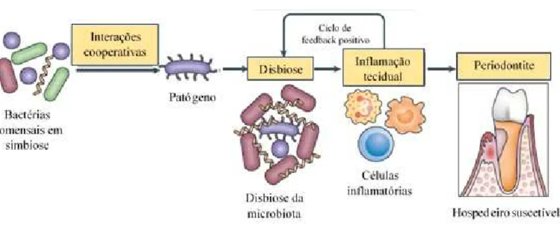 Figura 6  –  Periodontite induzida no hospedeiro suscetível pela comunidade microbiana [adaptado  de (Hajishengallis, 2014)].