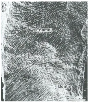 Figura 1. Fotomicrografia eletrónica do sistema complexo de prismas de esmalte e junção amelo- amelo-dentinária (DEJ) (adaptado de Hilton et al., 2013) 