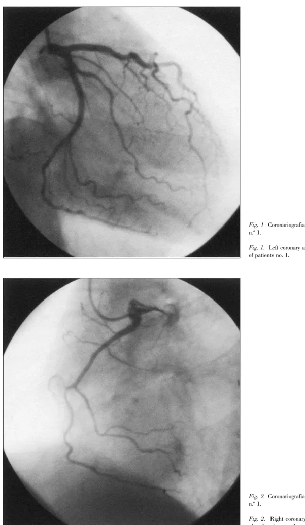 Fig. 1.  Left coronary angiography of patients no. 1.