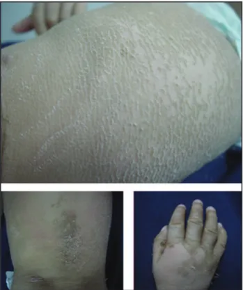 Figure 1. Generalized dry and scaly skin.