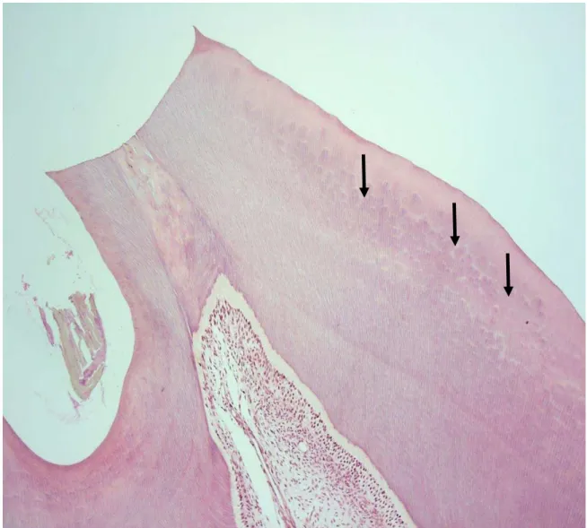 Figura  3. Dentina globular e interglobular (setas). (Cavacas, 2014) 