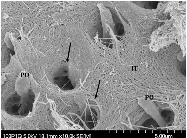 Figur a  4.  Image m  de  túbulos  dentinários  (setas),  malha  de  colagénio  na  dentina  intertubular  (IT)  e   prolongamentos odontoblásticos no interior dos túbulos (PO)