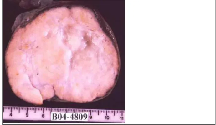 Figure 4 Microscopic examination.