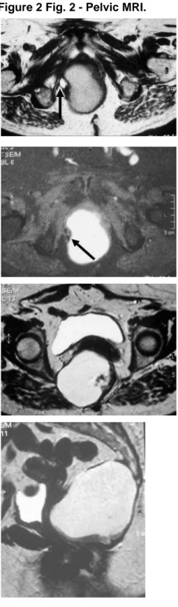 Figure 2 Fig. 2 - Pelvic MRI. 