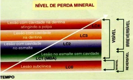 Figura 5 – Nível de perda mineral. Lesões de esmalte sem cavitação são reversíveis e não  necessitam de restauração