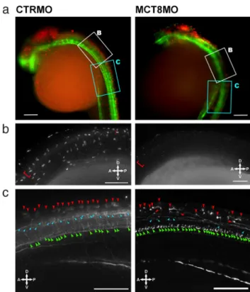 Figure 6. pax2a is a target of maternal THs in a context-related fashion. shha (A), fgf8a (B), and pax2a (C, D and, E) WISH expression in 25-hpf wild-type zebrafish embryos microinjected with either CTRMO or MCT8MO