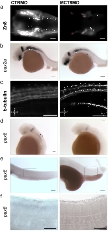 Figure 7. At 31 (A–D) and 48 (E and F) hpf, mct8 morphants have fewer hindbrain and spinal cord neurons