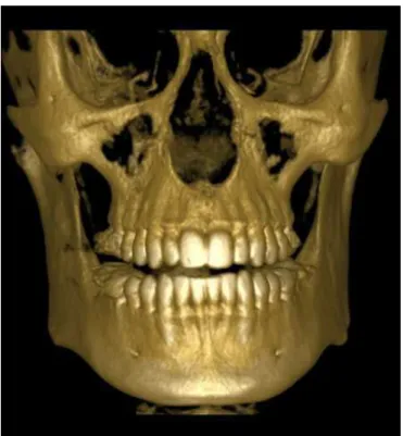 Figura 7: Reconstrução obtida com CBCT 