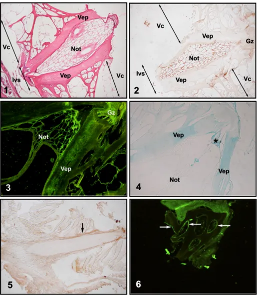 Fig. 8. Identiﬁcation of sites of Mgp accumulation in kidney and in heart of turbot. 1— Localization of Mgp accumulation in the urinary tubules, by immunoperoxidase (arrows); 2 — immunoﬂuorescence showed a more precise location of Mgp accumulation in the e