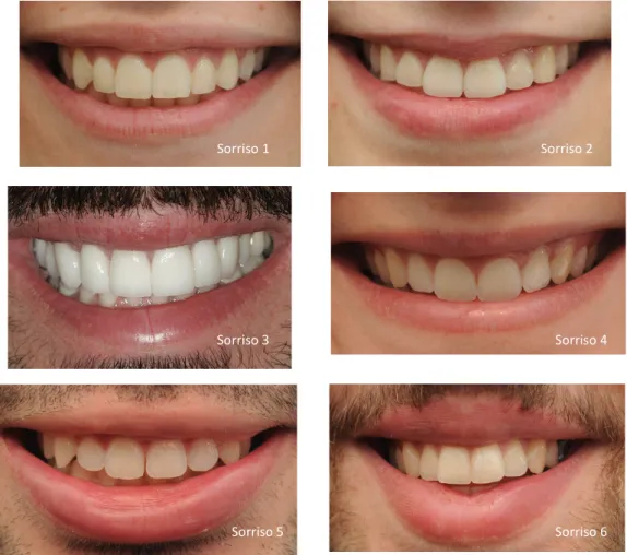 Figura 4 - Fotografias dos sorrisos apresentadas no questionário. (sem autorização do autor) [19] 