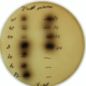 Figura 5:  Imagem de um crescimento de E. faecalis e outra espécie de Enterococcus  em meio de bilis-esculina (Adaptado de Portenier, 2003)