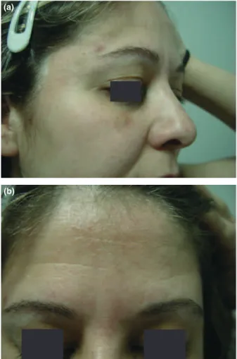 Figure 2 (a) and (b) After treatment with rituximab