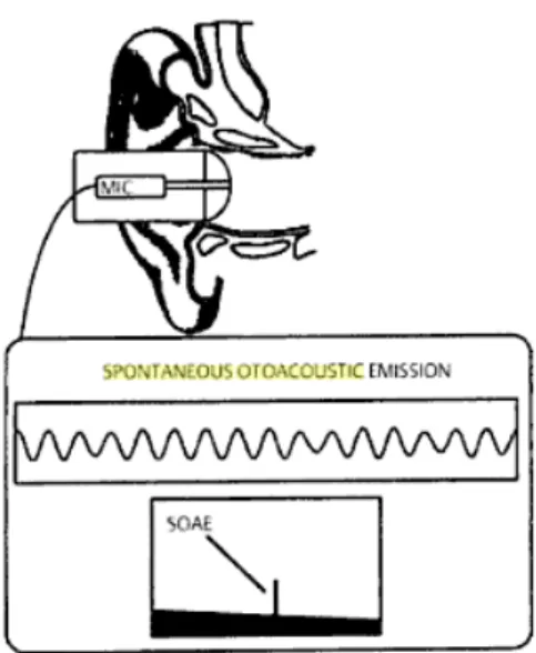 Figura 1 - Otoemissões Acústicas Espontâneas (Roeser, et al., 2007) 