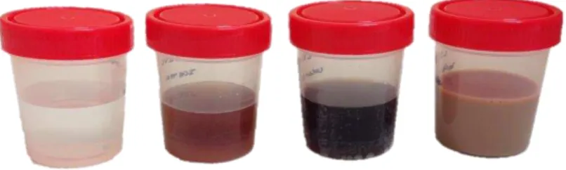 Figura 12. Recipientes e respetivos líquidos pigmentantes, utilizados para imersão das  amostras