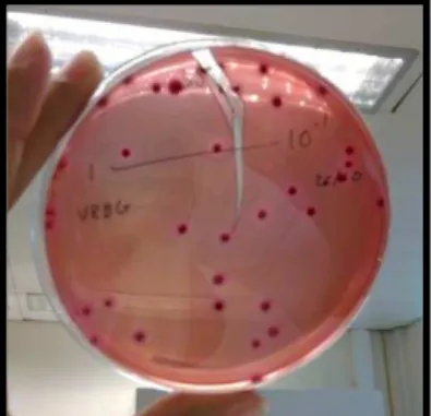 Figura 4.Colónias características de Enterobacteriaceae em meio VRBG (Fonte: Daniela Fernandes)