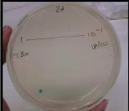 Figura 5. Colónia característica de Escherichia coli em meio TBX (Fonte: Daniela Fernandes) 