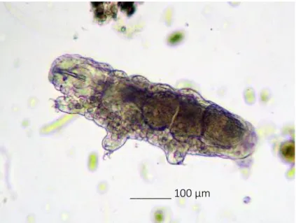 Figure 1.7. Microscope picture of a tardigrade (© Robert Pickett). 