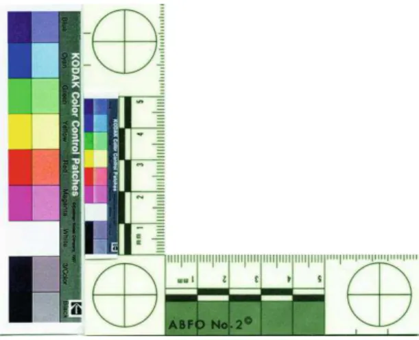 Figura 2 - Escala ABFO n.º 2